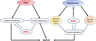 Androgen dysfunction in non-alcoholic fatty liver disease: Role of sex hormone binding globulin